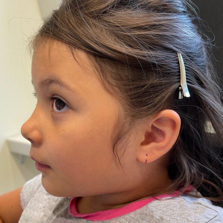 Poner pendientes a bebé